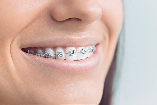 Why Choose Us for Your Dental Needs in Springfield, FL
